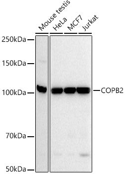 COPB2 Rabbit mAb