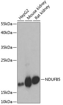 NDUFB5 Rabbit pAb