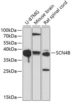 SCN4B Rabbit pAb