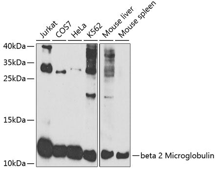 beta 2 Microglobulin Rabbit pAb
