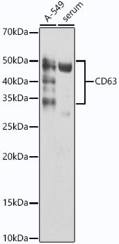 CD63 Rabbit mAb