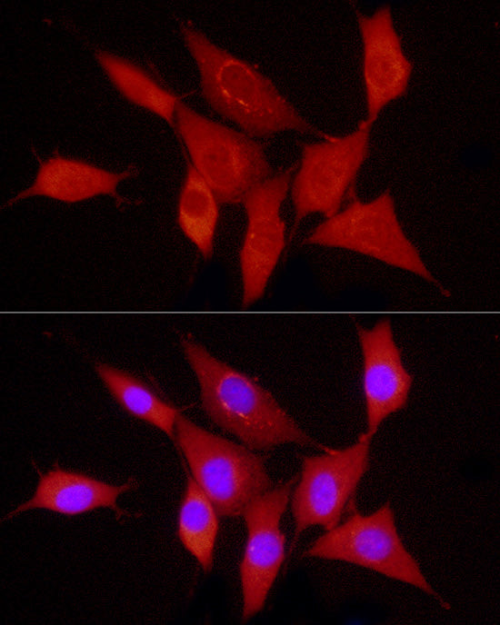 PDGFB Rabbit mAb