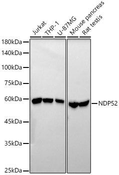 NDP52 Rabbit mAb