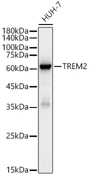 TREM2 Rabbit mAb