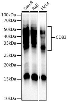 CD83 Rabbit mAb