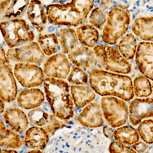FUNDC1 Rabbit mAb