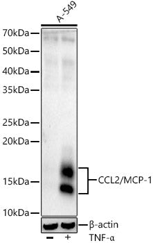 CCL2/MCP-1 Rabbit mAb