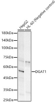 DGAT1 Rabbit mAb
