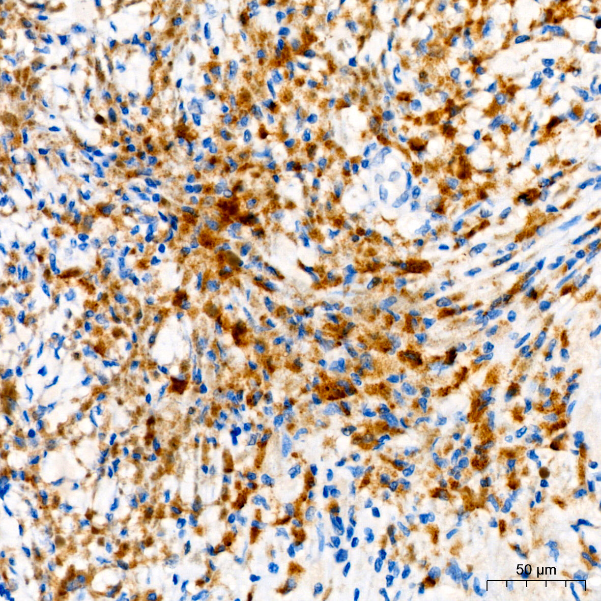Tyrosinase Rabbit mAb