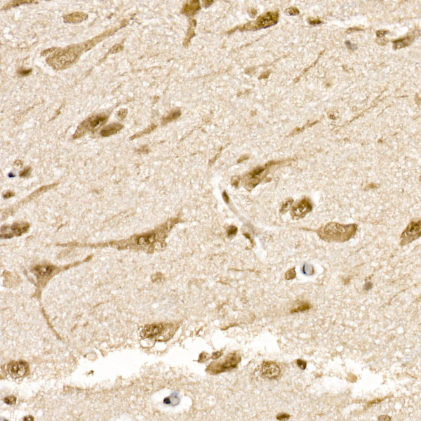 SOCS7 Rabbit mAb