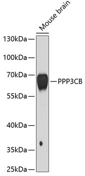 PPP3CB Rabbit pAb
