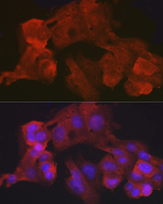 Villin1 Rabbit mAb
