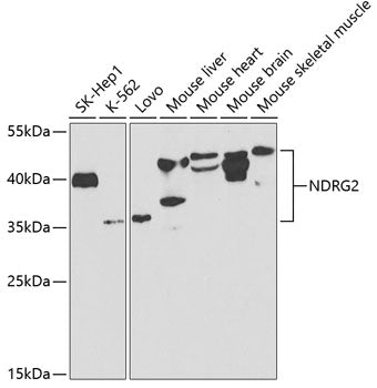 NDRG2 Rabbit pAb