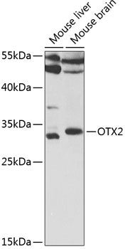 OTX2 Rabbit pAb
