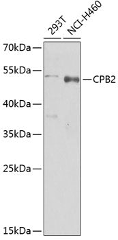 CPB2 Rabbit pAb