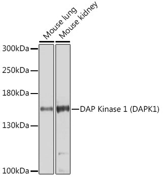 DAP Kinase 1 (DAPK1) Rabbit pAb