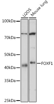 FOXF1 Rabbit mAb