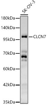 CLCN7 Rabbit pAb