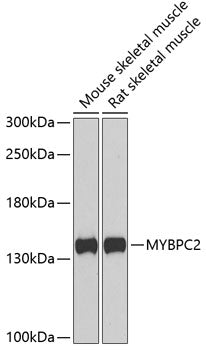 MYBPC2 Rabbit pAb