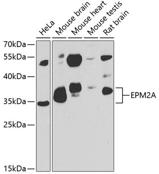 EPM2A Rabbit pAb