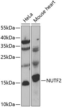 NUTF2 Rabbit pAb