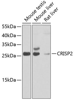 CRISP2 Rabbit pAb