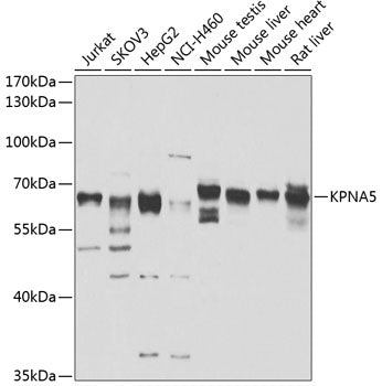 KPNA5 Rabbit pAb