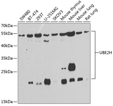 UBE2H Rabbit pAb