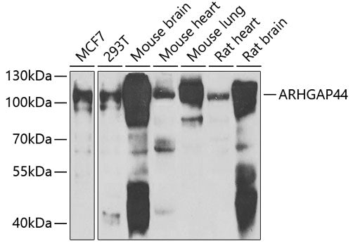 ARHGAP44 Rabbit pAb