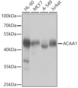 ACAA1 Rabbit pAb