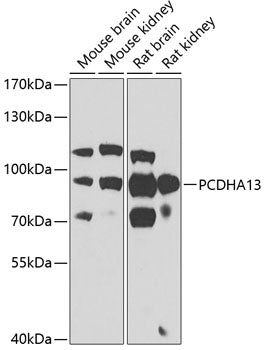 PCDHA13 Rabbit pAb