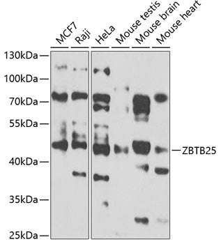 ZBTB25 Rabbit pAb