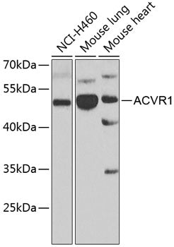 ACVR1 Rabbit pAb