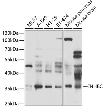 INHBC Rabbit pAb