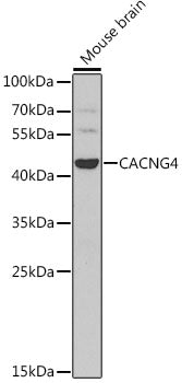 CACNG4 Rabbit pAb