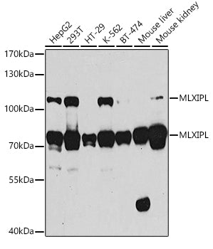 MLXIPL Rabbit pAb