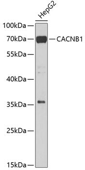 CACNB1 Rabbit pAb