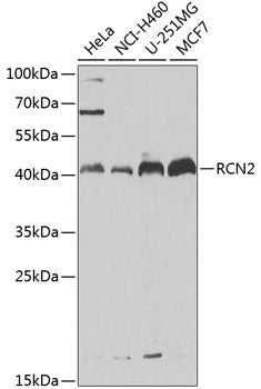 RCN2 Rabbit pAb