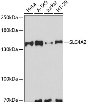 SLC4A2 Rabbit pAb