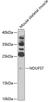 NDUFS7 Rabbit pAb