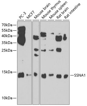 SSNA1 Rabbit pAb