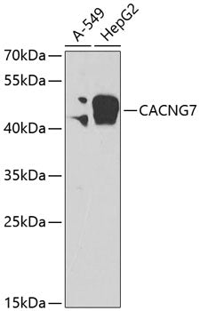 CACNG7 Rabbit pAb