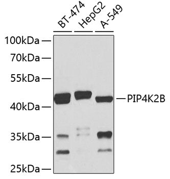PIP4K2B Rabbit pAb