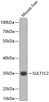SULT1C2 Rabbit pAb