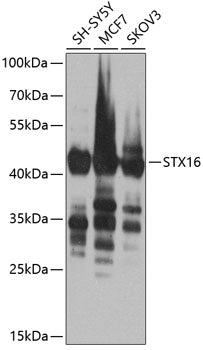 STX16 Rabbit pAb