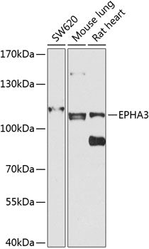 EPHA3 Rabbit pAb