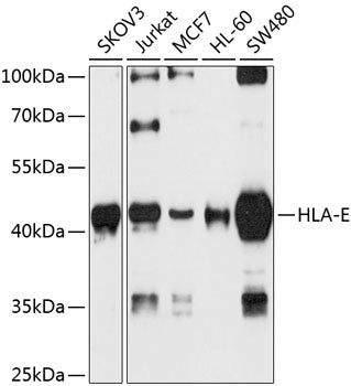 HLA-E Rabbit pAb
