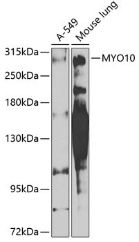 MYO10 Rabbit pAb