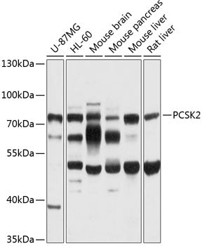 PCSK2 Rabbit pAb