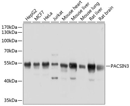 PACSIN3 Rabbit pAb